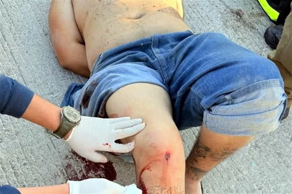 Hombre armado con machete es neutralizado por la policía tras causar disturbios en El Salto